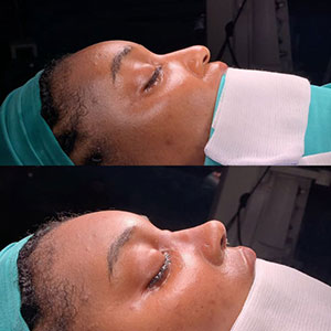 before-after