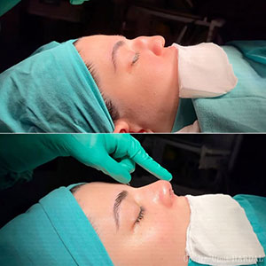 before-after