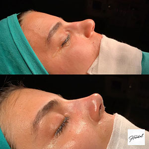 before-after
