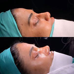 before-after