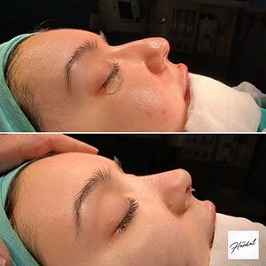 before-after