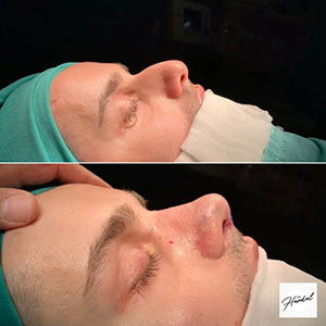 before-after
